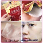 5-mat-na-huyet-thanh-edally-han-quoc-min.jpg
