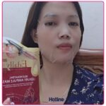 7-mat-na-huyet-thanh-edally-han-quoc-min.jpg